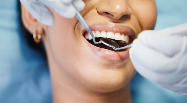 Best Weekend Emergency Dentist in Fearrington Village, NC