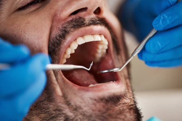 Best After-Hours Emergency Dentist in Fearrington Village, NC